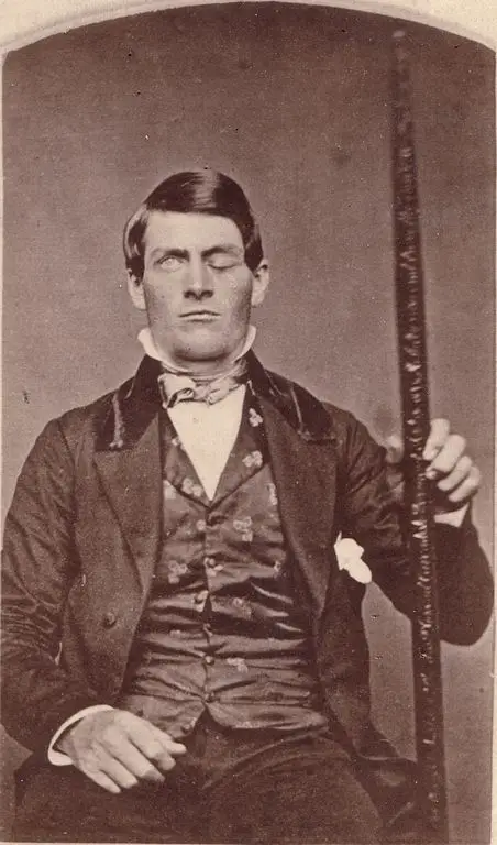 Photo of Phineas Gage